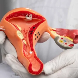 Gynaecology