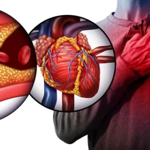 Heart disease
