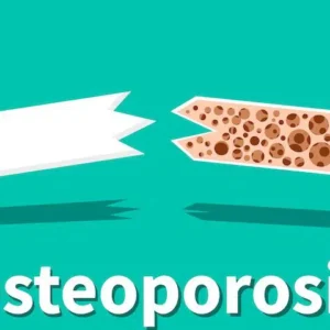 osteoporosis