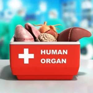 transplant